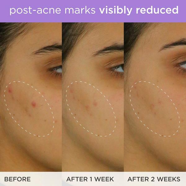 Ulta TATCHA  The Brightening Serum