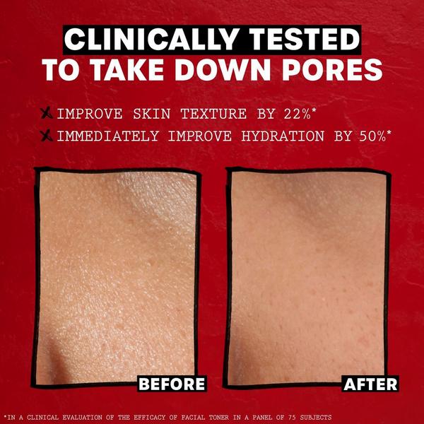 Ulta Thayers  Alcohol-Free Witch Hazel Facial Toner