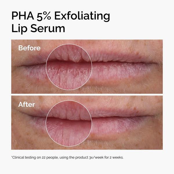 Ulta The Ordinary  PHA 5% Exfoliating Lip Serum