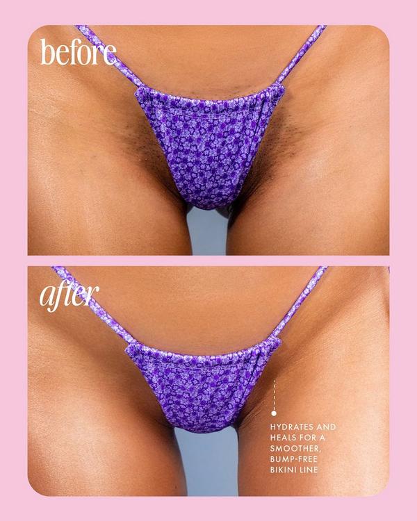 Ulta Truly  Cooka Concentrate Ingrown Serum