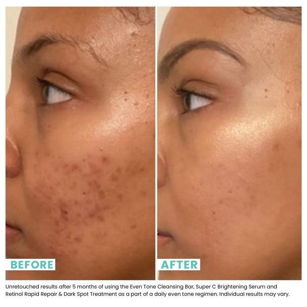 Ulta Urban Skin Rx  Even Tone Cleansing Bar 3-in-1 Treatment